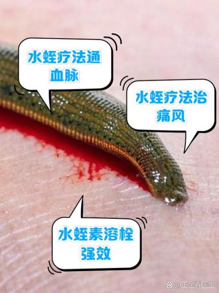 梦到水蛭吸血_是什么意思