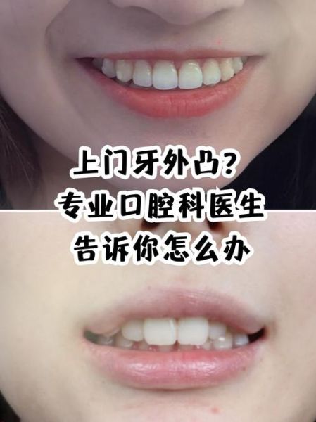 牙齿外突有财运吗_牙齿外突面相财运解析