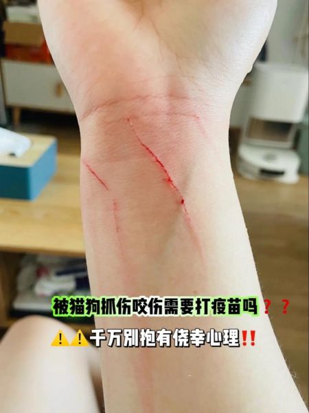梦到被狗抓出血_梦见狗抓伤流血是什么意思