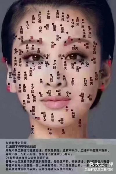 哪些痣财运好_脸上长痣会破财吗