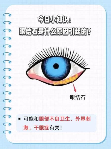 梦到眼睛里有异物_意味着什么