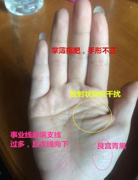 财运线很多杂纹怎么办_如何化解