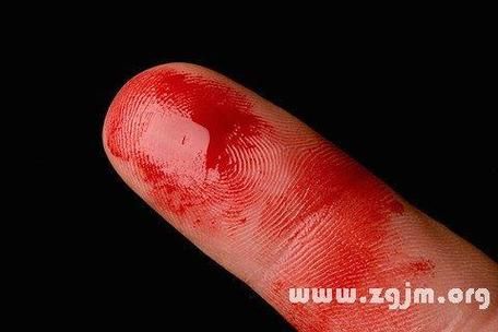 梦到手很黑_意味着什么