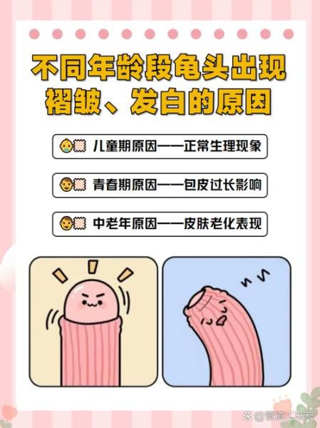 龟头与财运有关系吗_龟头形状影响财富运势吗