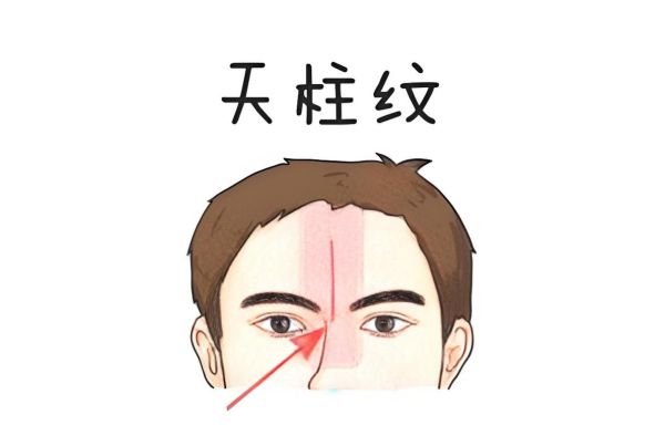眉心纹运势_眉间竖纹代表什么