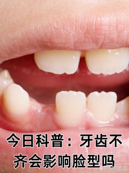牙齿不齐会影响财运吗_牙齿不齐真的破财吗