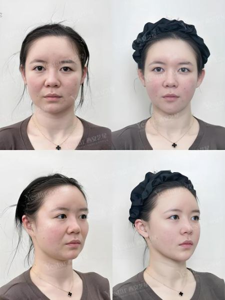 面部整容会影响财运吗_面部整容对运势的影响
