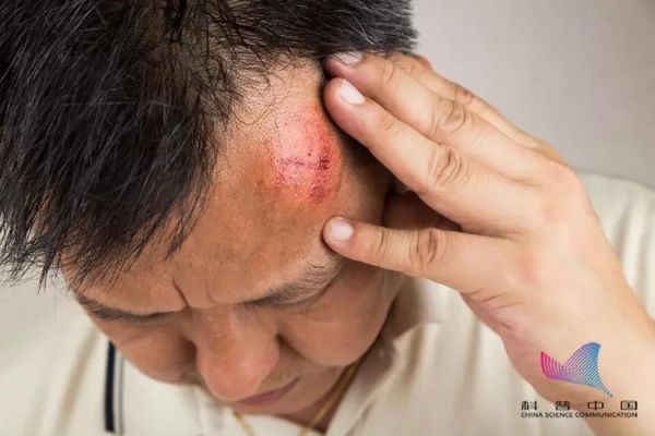 梦到被砍伤流血_是什么预兆