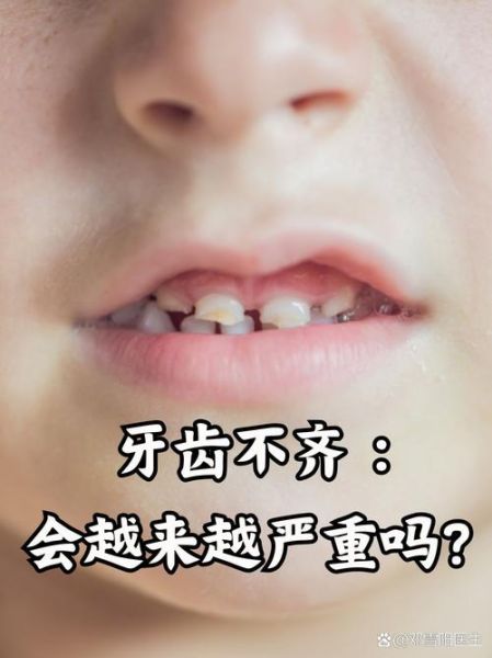 牙不齐影响财运吗_牙不齐怎么改运