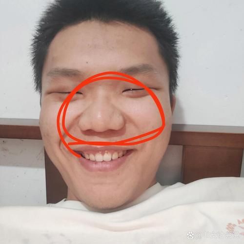 蒜头鼻运势如何_蒜头鼻面相财运好吗