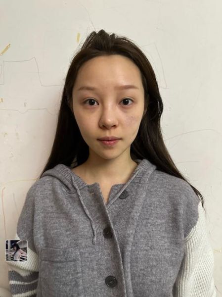 隆鼻真能改善财运吗_隆鼻改变面相风水靠谱吗