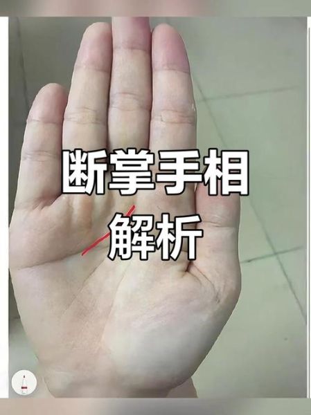 假断掌的男人财运如何_假断掌的男人能发财吗