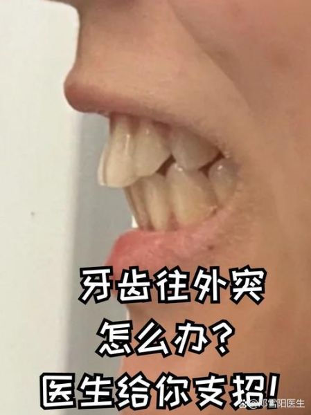 牙齿外凸有财运吗_牙齿外凸影响运势吗