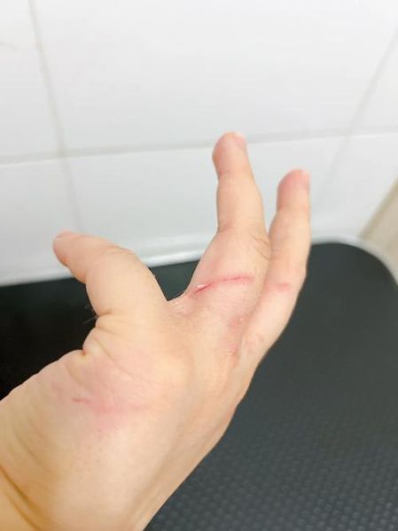 梦到被猫抓伤是什么意思_梦见猫抓伤自己预示什么