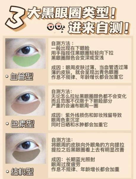 梦到黑眼圈是什么意思_如何缓解黑眼圈