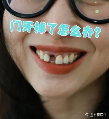 大门牙掉了影响财运吗_门牙掉了风水说法
