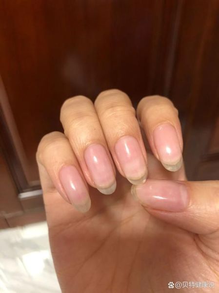 指甲白点小指_财运真的有关吗