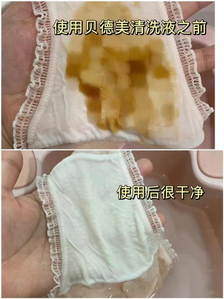 梦到经血弄脏内裤_是什么意思