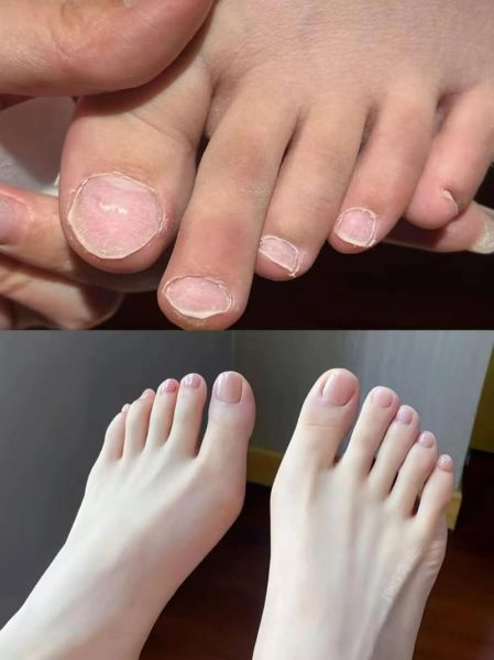 梦到剪自己的脚指甲_是什么预兆