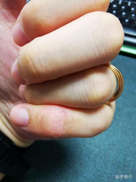 梦到鬼咬手是什么意思_梦见鬼咬手怎么破解