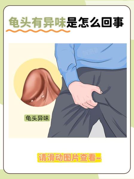 梦到吃龟头是什么意思_梦见吃龟头预示什么