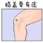 膝盖圆财运_膝盖圆的人财运好吗