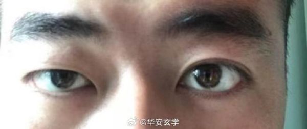 雌雄眼财运_雌雄眼面相财运好吗