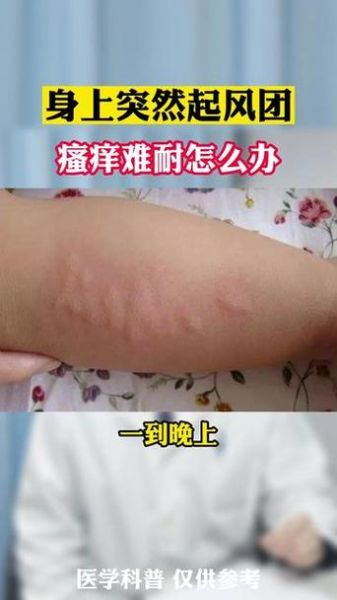 梦到浑身包是什么意思_梦见身上起疙瘩预示什么