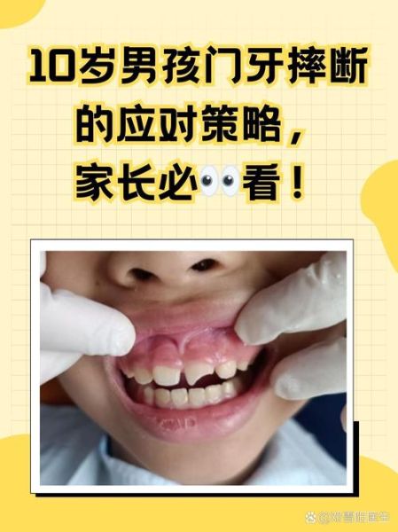 门牙掉了一小块运势_门牙缺损影响风水吗
