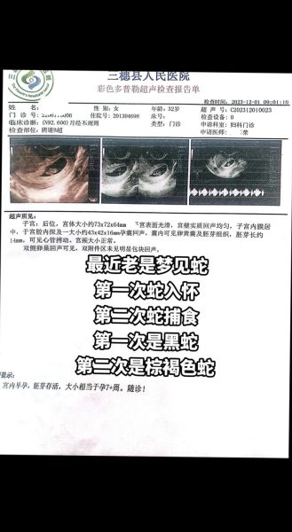 胎梦梦到黑蛇是什么意思_孕妇梦见黑蛇生男生女