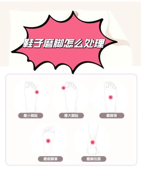 梦到鞋磨脚是什么意思_梦到鞋磨脚预示着什么