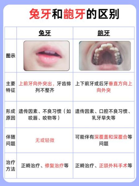 暴牙会影响财运吗_暴牙面相财运解析