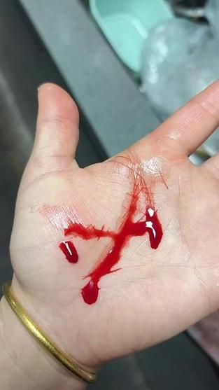 梦到手被割破流血_是什么意思