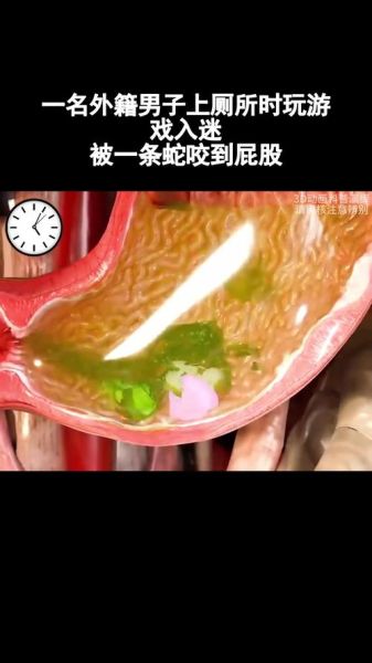 女人梦到屁股被蛇咬了_是什么预兆
