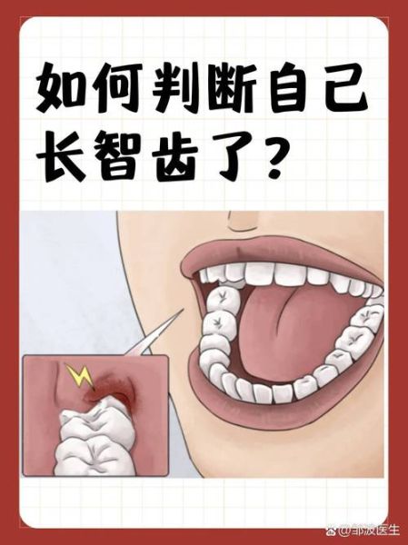 长智齿代表什么运势_智齿与命运的关系