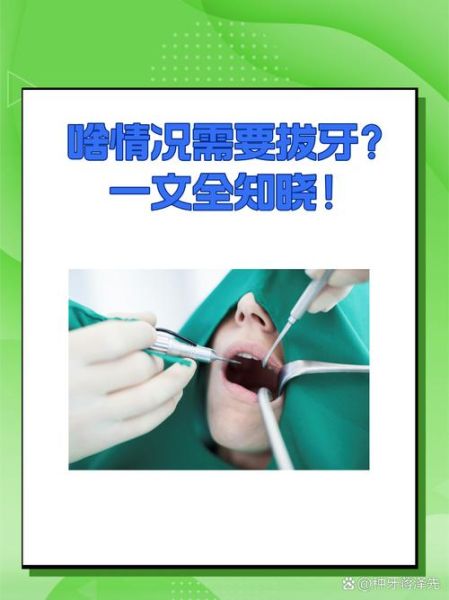 梦到拔牙是什么意思_梦见自己拔牙好不好