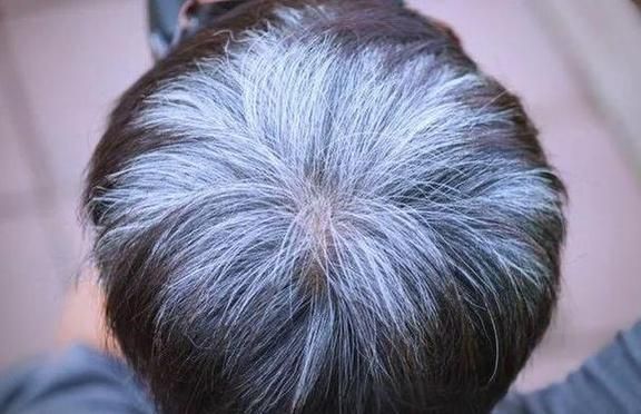 梦到头发长长了_意味着什么