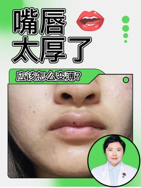 上嘴唇短财运真的不好吗_如何改善