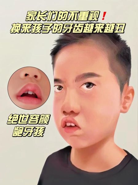 龅牙的人财运好是真的吗_面相学怎么解释