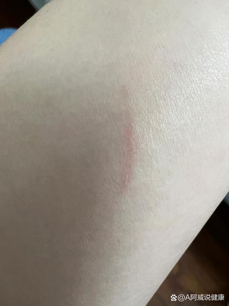 梦到被猫抓伤出血_是什么意思