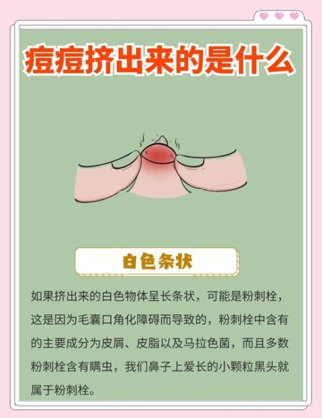 梦到挤痘痘_代表什么含义