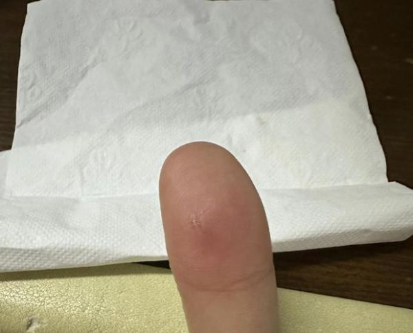 梦到玻璃扎手_是什么意思