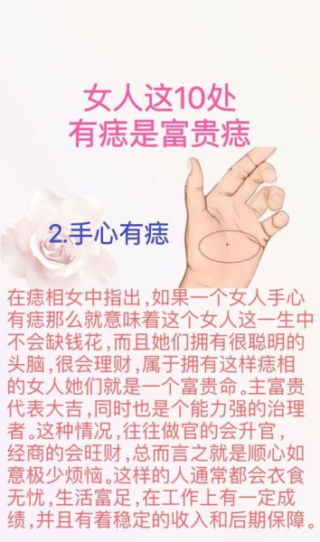 阻挡财运的痣有哪些_如何化解财运痣