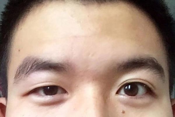 雌雄双眼财运_雌雄眼面相能招财吗