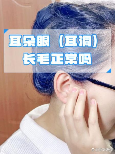 耳朵长毛财运_耳朵长毛是富贵相吗