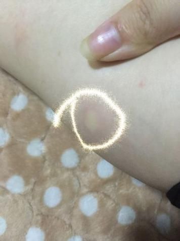梦到腿上有个洞_意味着什么