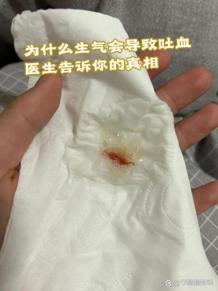 梦到别人吐血是什么意思_梦见别人吐血预示什么