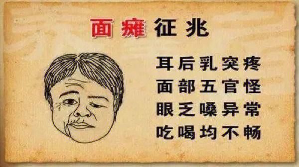 面瘫会影响运势吗_面瘫面相风水解读