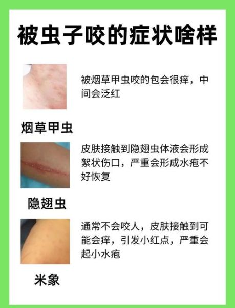 梦到虫子咬自己是什么意思_梦到虫子咬自己预示什么