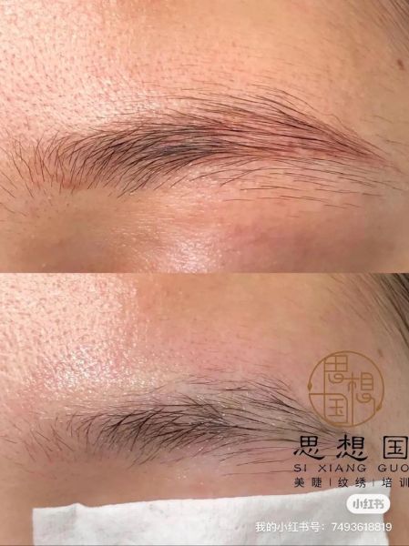 眉毛痒是财运来了吗_眉毛痒预示什么